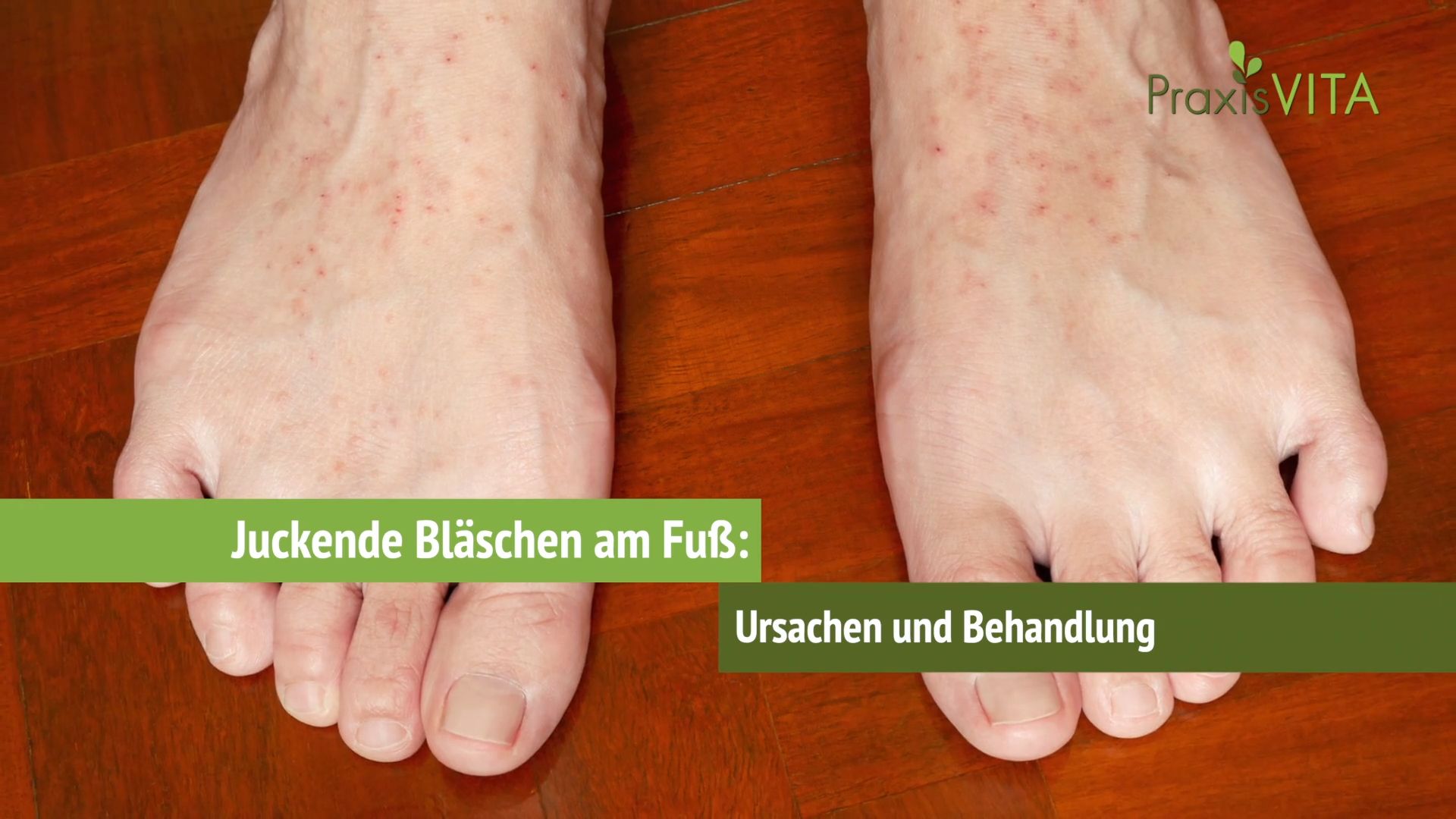F e Jucken Das Kann Hinter Einem Juckreiz Stecken MSQVWU